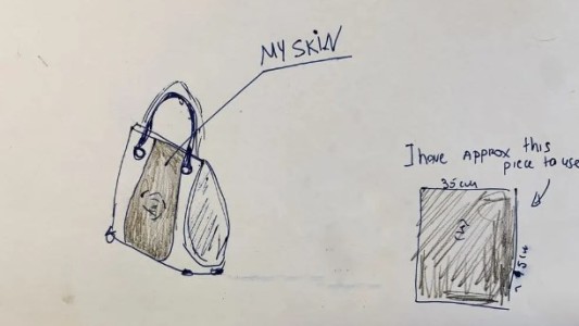 Una mujer inglesa quiere hacerse una cartera con piel de su pie amputado