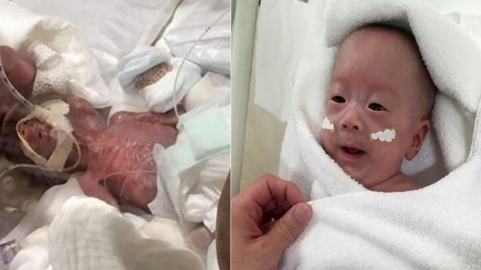 "No creía que pudiera sobrevivir": salió del hospital el bebé que nació con 268 gramos