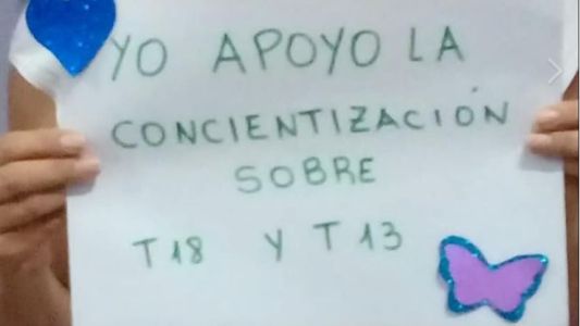 Se celebra el Día Mundial del Síndrome de Edwards o Trisomía 18