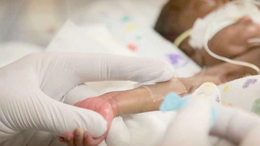 El extraño caso de la beba que nació "embarazada" de su hermano gemelo