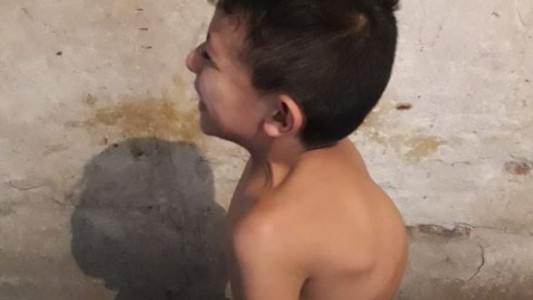 Nene con escoliosis progresiva necesita insumos para ser operado en el Garrahan