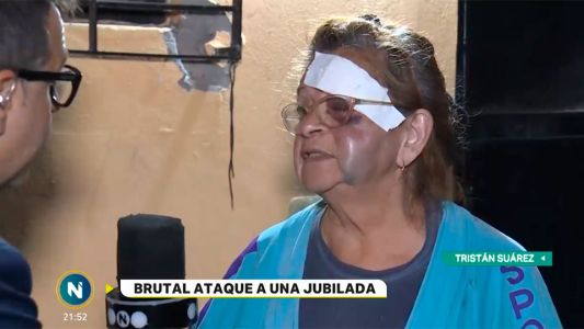 Brutal ataque a una jubilada en Tristán Suárez
