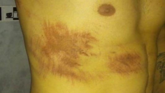 Detuvieron a seis policías acusados de torturar a una pareja gay en Santa Fe