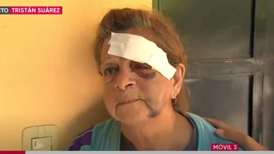 Le pegaron para robarle y a un vecino le dispararon cuando quiso ayudarla