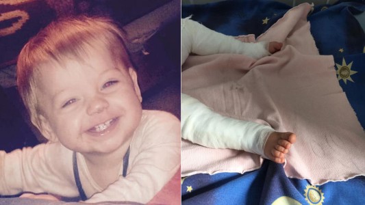 Ucrania: murió un bebé que cayó en un balde de agua hirviendo