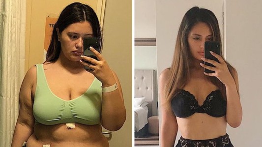 La joven que bajó 68 kilos y muestra cómo le quedó el cuerpo en Instagram