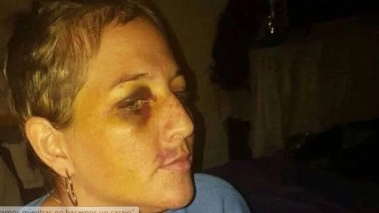 El calvario de Betiana: su ex pareja la golpeó brutalmente y le cortó el pelo