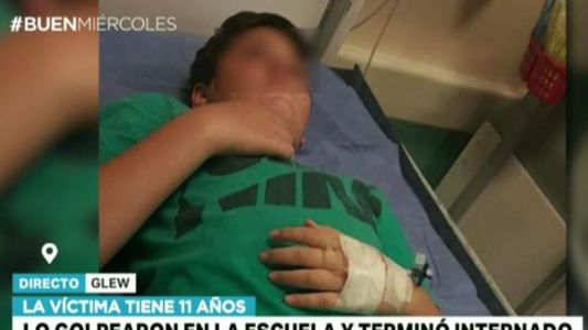 Un nene sufrió una golpiza en la escuela y terminó internado
