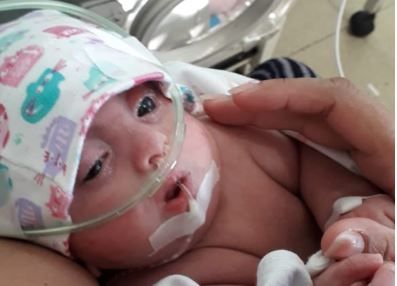 Beba de 3 meses con Trisomía 18 necesita pañales