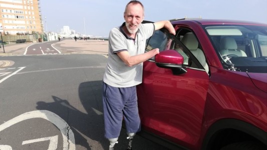 El hombre que deicidió que le amputen las manos y las piernas para sobrevivir