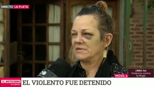 Habló Vanesa, la mujer atropellada por su pareja "me dejó sin dientes"