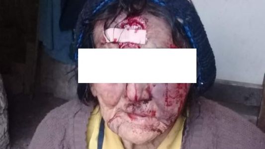 Desfiguraron a golpes a una mujer de 83 años para robarle un televisor y una garrafa