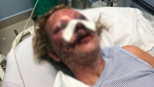 El terrible relato de la mujer que sobrevivió al salvaje ataque de un hombre en Punta Cana