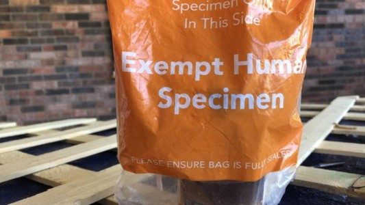 Compró unas cortinas de baño por Internet, pero recibió a cambio una muestra de orina