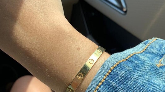 El enigma viral que asegura que todas las mujeres tienen un lunar en la muñeca