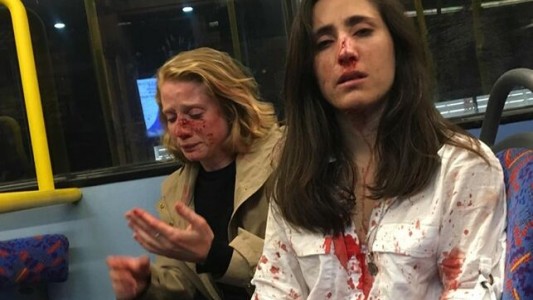 "Querían que nos besáramos": brutal paliza a una azafata uruguaya y a su novia