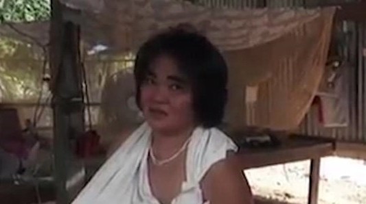 El extraño caso de la mujer a la que no le paran de crecer los pechos