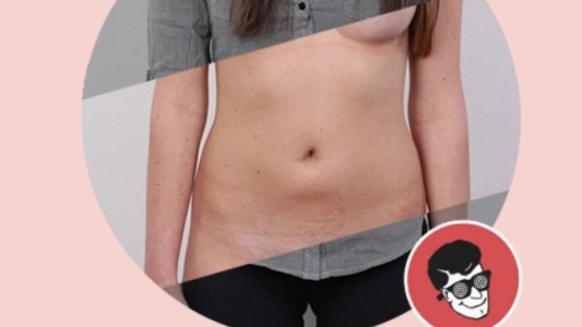 Polémica por una aplicación que "desnuda" a mujeres usando sus fotos vestidas