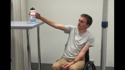 Transferencia de nervios y tendones: 13 personas tetrapléjicas pudieron volver a usar sus brazos