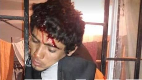Otro delincuente quedó atrapado en las rejas al huir de la casa que había robado
