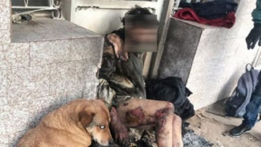 Brutal ataque en Santa Fe: prendieron fuego a un hombre en situación de calle