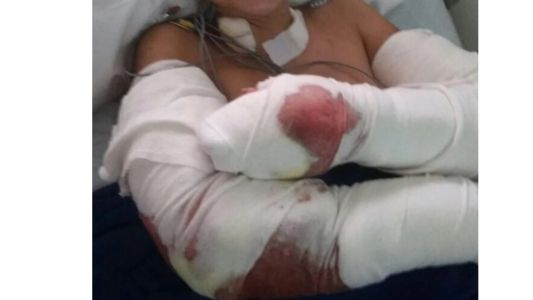 Fue atacada por tres perros en Punta Mogotes y se metió en el mar para salvarse