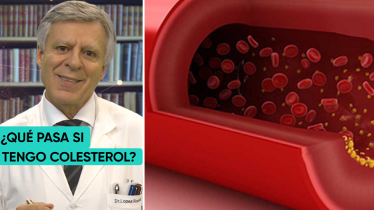 Los Consejos del Doc: ¿Qué pasa si tengo colesterol?