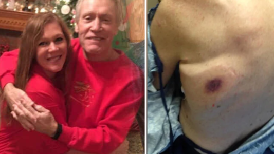 Nuevo caso mortal de la "bacteria come carne": un hombre falleció en 48 horas