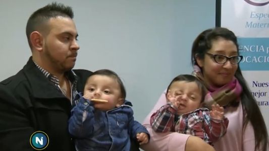 Separaron a los siameses Gianluca y Santino: procedimiento inédito en Argentina