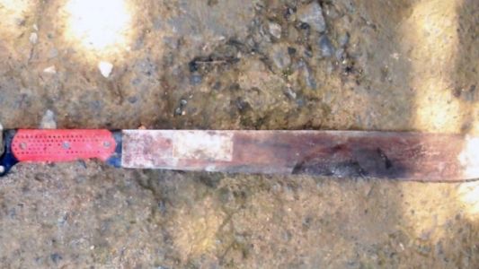 Encontró a su esposa teniendo sexo con el amante y le cortó el pene con un machete