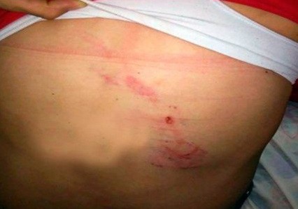 #NiUnaMenos Una mujer fue atacada a cadenazos por su sobrino político