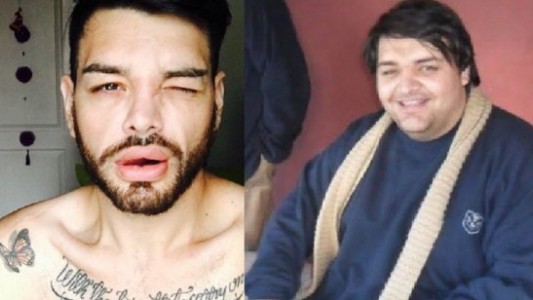 El joven que se operó 27 veces para parecerse a Ricky Martin