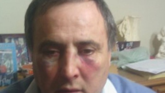 Brutal agresión de un padre y su hijo a director de una escuela