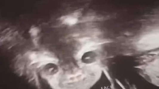 Se hizo una ecografía y dice que su hija "se parece al diablo"