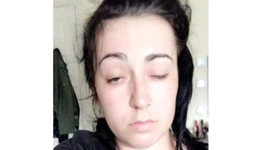 Esta selfie le salvó la vida: tomó la foto y colapsó