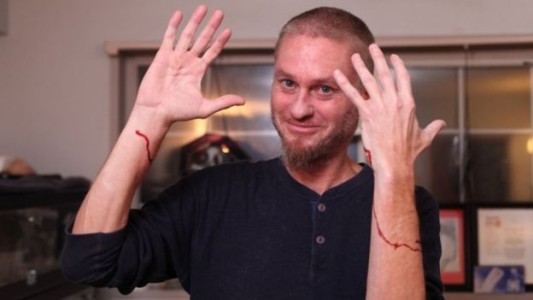 El joven que se dejó morder por 200 serpientes venenosas en busca del antídoto universal