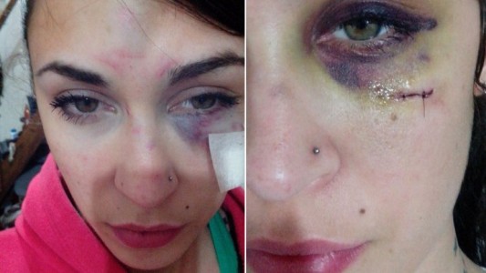 Denunció en Facebook que fue golpeada por su ex novio