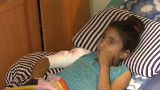 Un  rottweiler atacó a una nena de 9 años y está viva "de milagro"