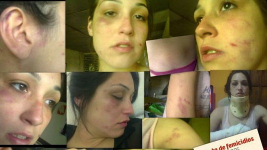 Una mujer fue brutalmente golpeada por su novio y se animó a contarlo en Facebook