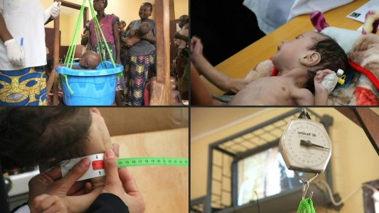 Uno de cada tres niños pequeños sufre desnutrición o sobrepeso en el mundo