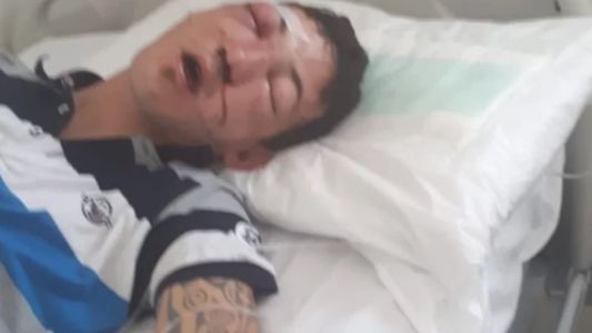 Quiso defender a una chica a la salida de un boliche y dos policías lo molieron a golpes