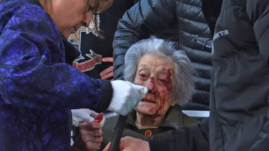 Ladrones golpearon brutalmente a una abuela de 91 años