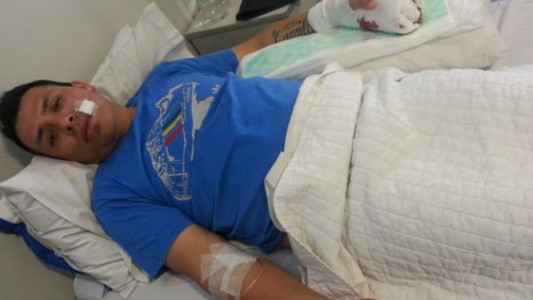 Subieron al colectivo, asaltaron al chofer y le cortaron un dedo