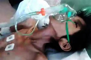 Chaco: murió un chico qom de 14 años que pesaba 10 kilos