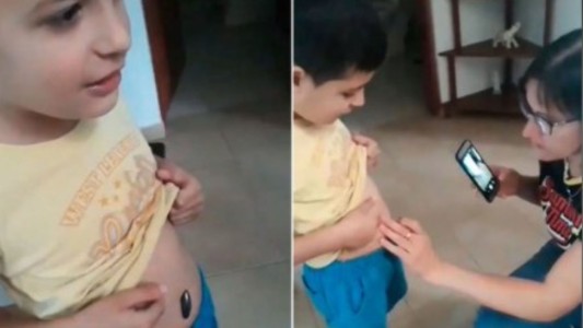 Polémico: un nene se tragó un imán y su familia viralizó un video en tono jocoso