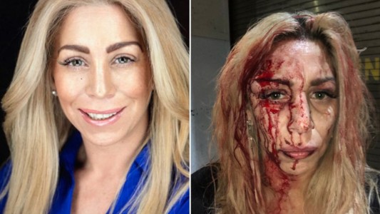 Feroz ataque racista a dos modelos en un bar de Nueva York