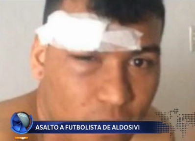 Asaltaron a un futbolista de Aldosivi