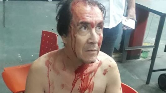 Un chofer de la línea 140 sufrió brutal asalto