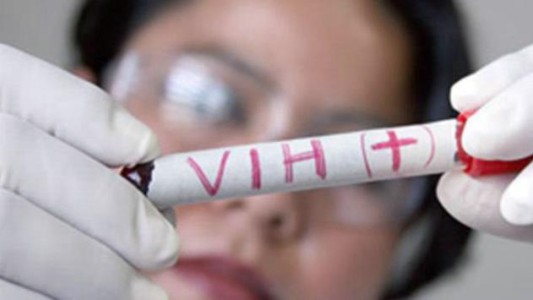 Descubren método para eliminar células con infección latente de VIH