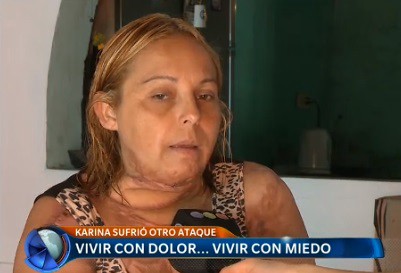 La quemaron y ahora la intentaron atropellar